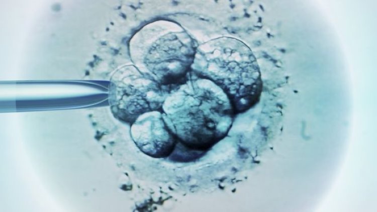 Tüp bebekler için spermini kullanmakla suçlanan doktora DNA testi