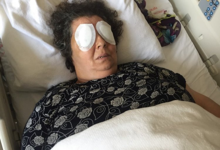 Hastanede dehşet: Şizofren kadın, bir hastanın gözlerini çıkarıp yedi!