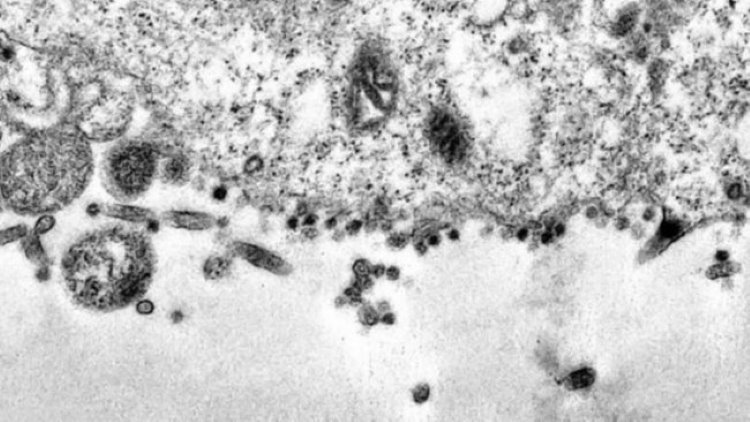 Koronavirüsün hücrelere saldırı anı görüntülendi