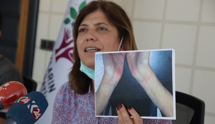HDP, Diyarbakır'daki işkencenin belgelerini paylaştı: Açıklama bekliyoruz