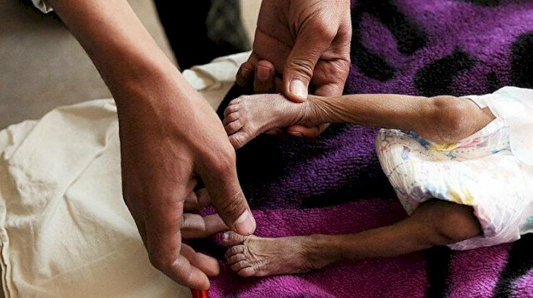Açlık virüsü çoğalıyor: Dünya genelinde her 1 dakikada 11 insan açlıktan ölüyor