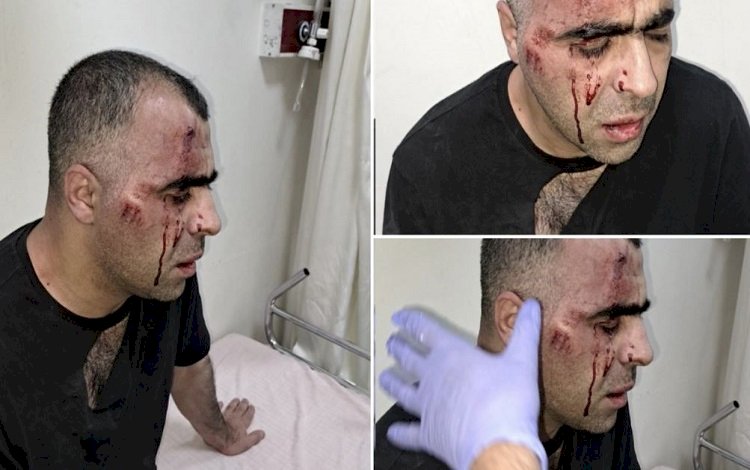 Gazeteci Sinan Aygül: 'Tatvan belediye başkanının korumalarının saldırısına uğradım'
